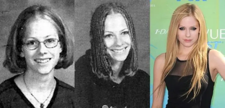 IZ ŠMOKLJANA IZRASLI U ZVIJEZDE: Čak i slavni su morali proći kroz neugodnosti puberteta, pogledajte kako su izgledali