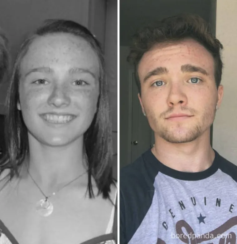 NEVJEROJATNA TRANSFORMACIJA: Objavili fotke prije i nakon promjene spola, gotovo ih je nemoguće prepoznati