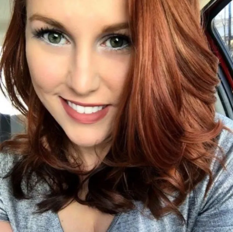 VATRENI SEKSEPIL: I crvenokose su žrtve predrasuda, a ove fotografije ih samo potvrđuju