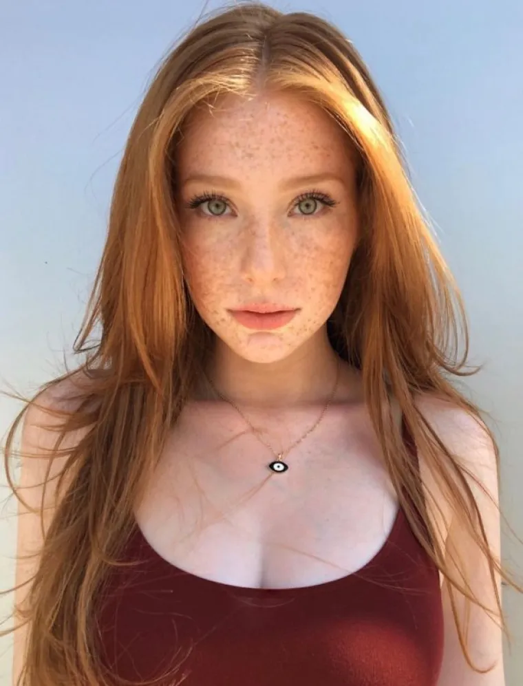 VATRENI SEKSEPIL: I crvenokose su žrtve predrasuda, a ove fotografije ih samo potvrđuju