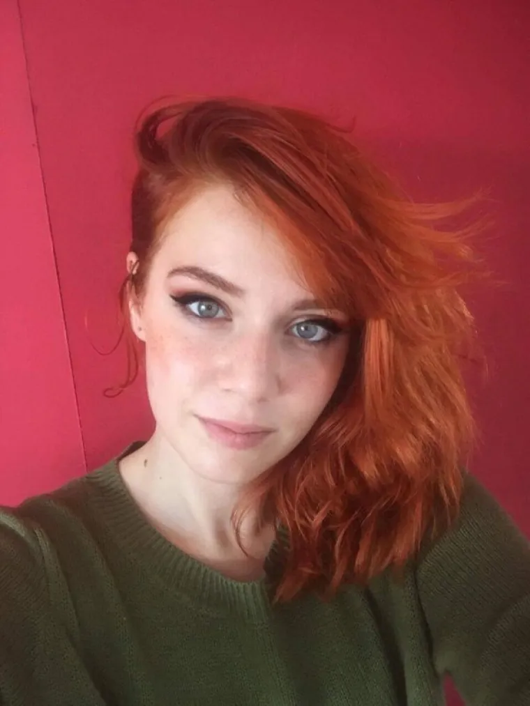 VATRENI SEKSEPIL: I crvenokose su žrtve predrasuda, a ove fotografije ih samo potvrđuju