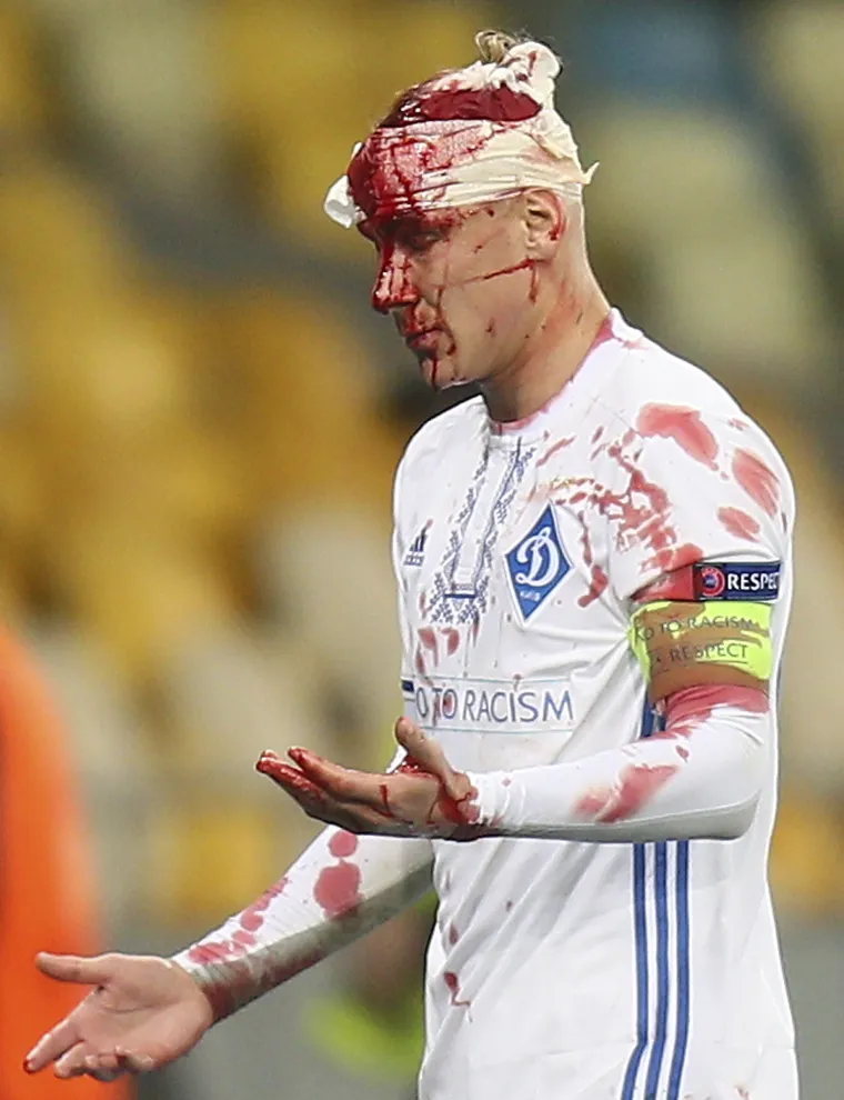 Viktor Vida raskrvario glavu tijekom utakmice