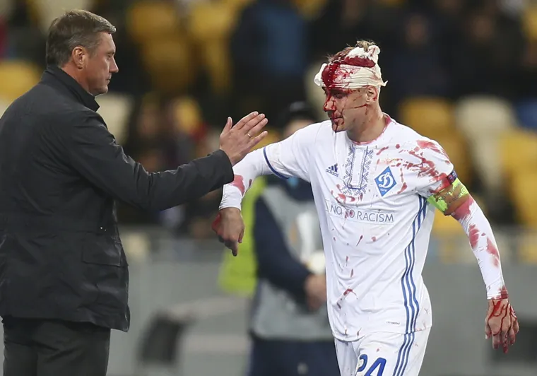 Viktor Vida raskrvario glavu tijekom utakmice