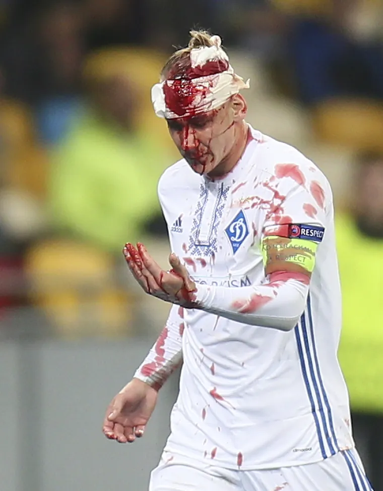 Viktor Vida raskrvario glavu tijekom utakmice