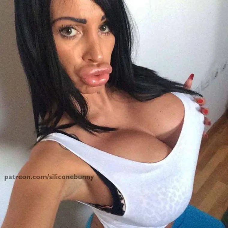 TOLIKO SE IZOPERIRALE DA IM NE TREBA MASKA ZA NOĆ VJE&Scaron;TICA: S razlogom ih zovu kraljicama silikona