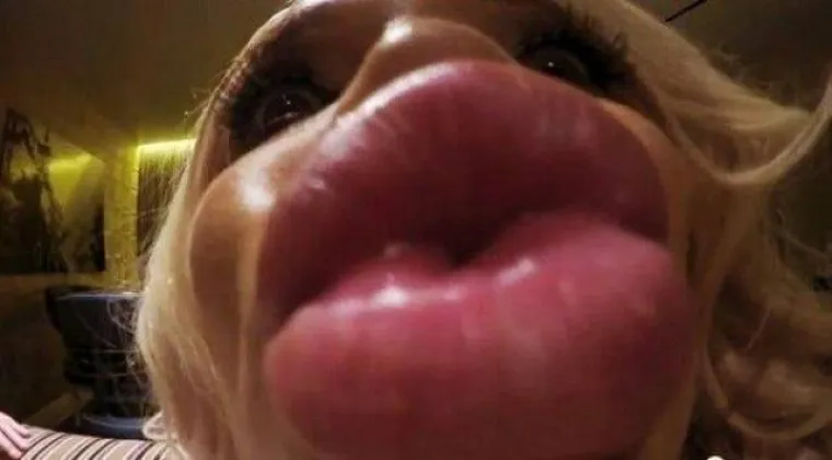 TOLIKO SE IZOPERIRALE DA IM NE TREBA MASKA ZA NOĆ VJE&Scaron;TICA: S razlogom ih zovu kraljicama silikona