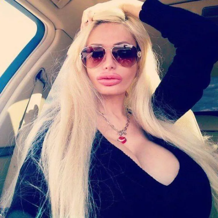 TOLIKO SE IZOPERIRALE DA IM NE TREBA MASKA ZA NOĆ VJE&Scaron;TICA: S razlogom ih zovu kraljicama silikona