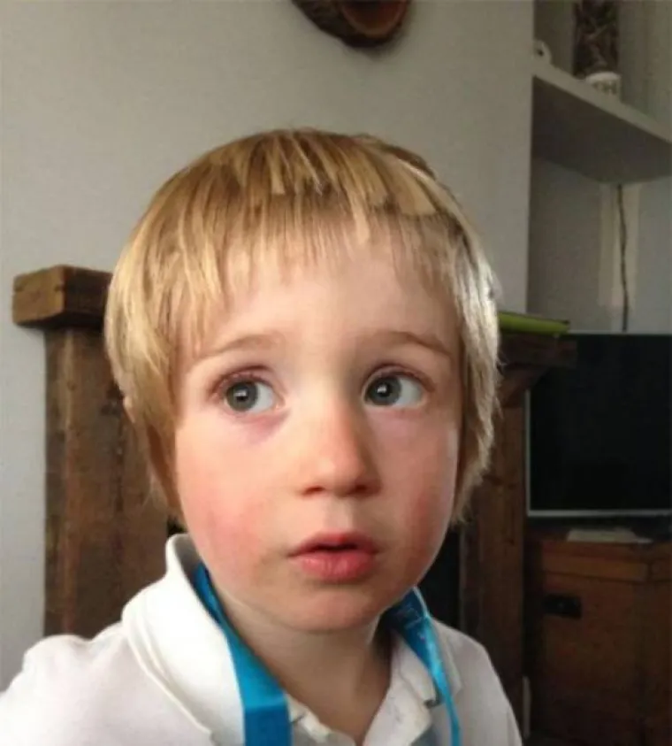 KAD SE DJECA DOKOPAJU &Scaron;KARA: Poku&scaron;ali se sami o&scaron;i&scaron;ati, rezultati su urnebesni