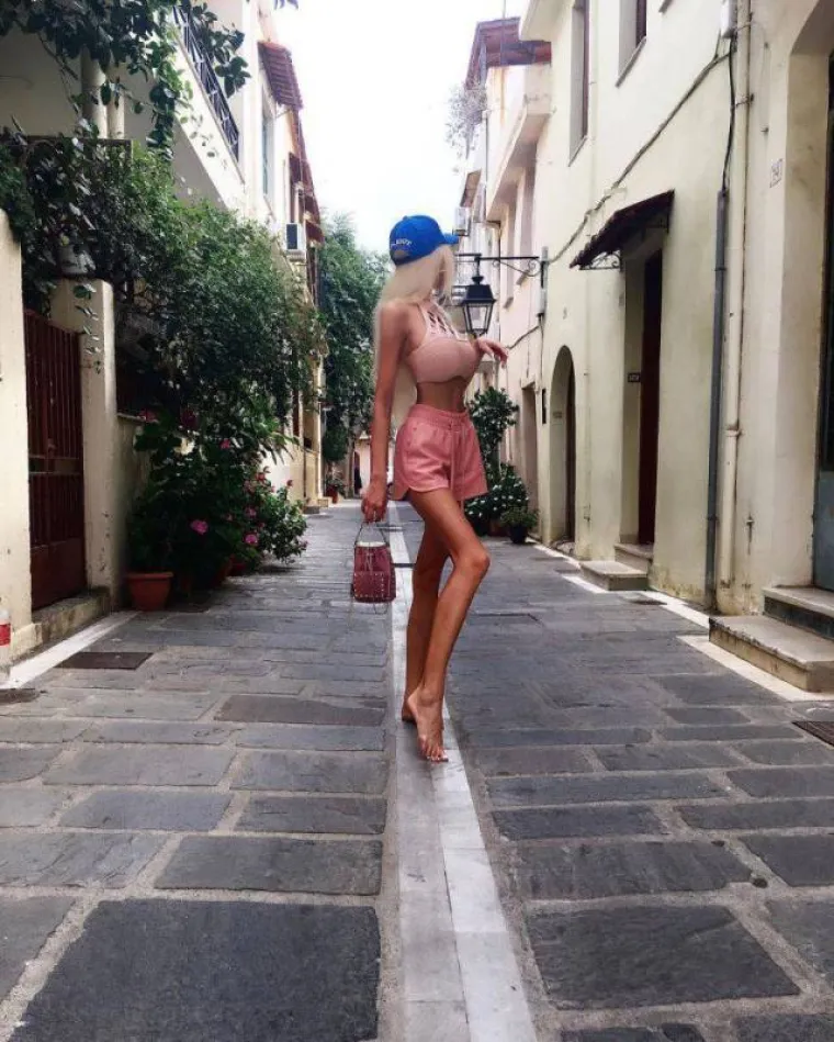 POTRO&Scaron;ILA VI&Scaron;E OD 250.000 KUNA NA PLASTIČNE OPERACIJE: Obožava plastiku jer želi postati ba&scaron; poput Barbike