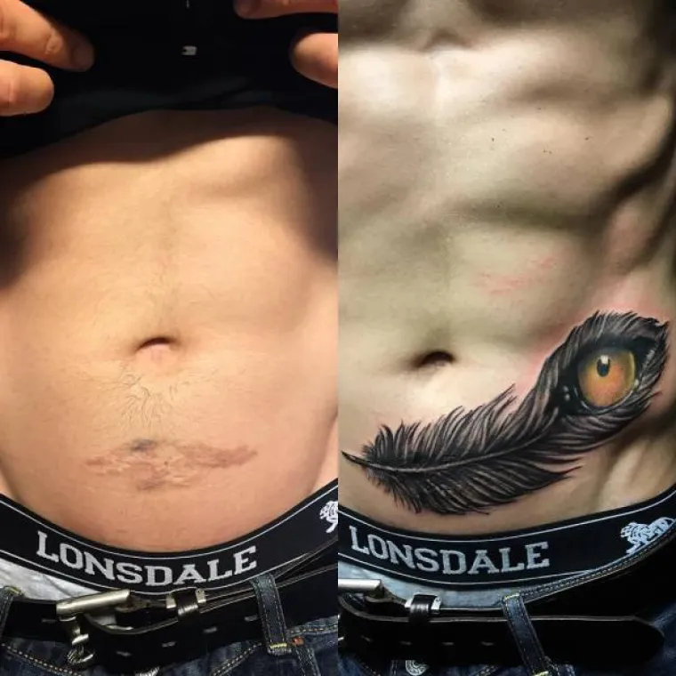 DUBOKE OŽILJKE PREKRILI TETOVAŽAMA: Od rana iz pro&scaron;losti uspjeli napraviti prava umjetnička djela