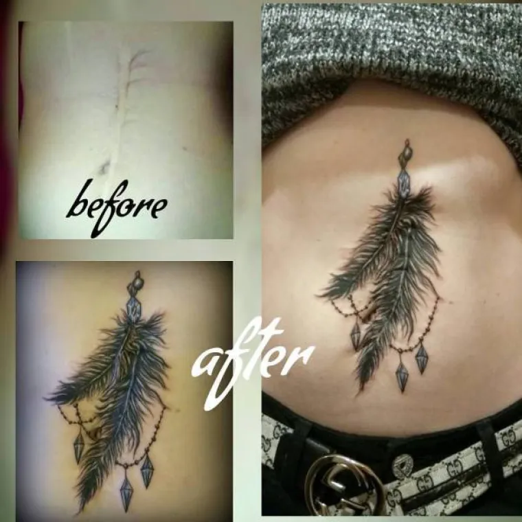 DUBOKE OŽILJKE PREKRILI TETOVAŽAMA: Od rana iz pro&scaron;losti uspjeli napraviti prava umjetnička djela