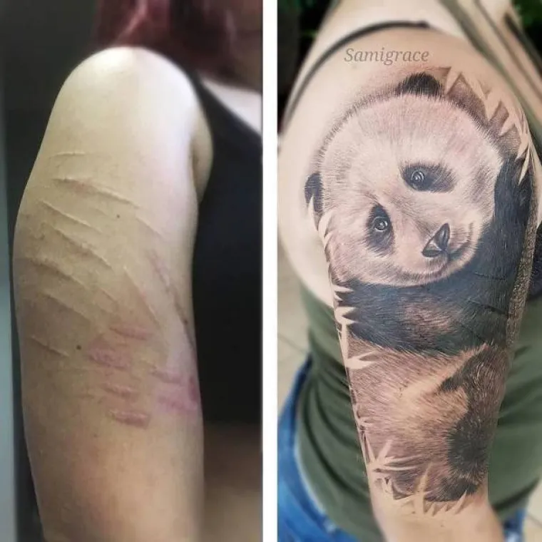 DUBOKE OŽILJKE PREKRILI TETOVAŽAMA: Od rana iz pro&scaron;losti uspjeli napraviti prava umjetnička djela