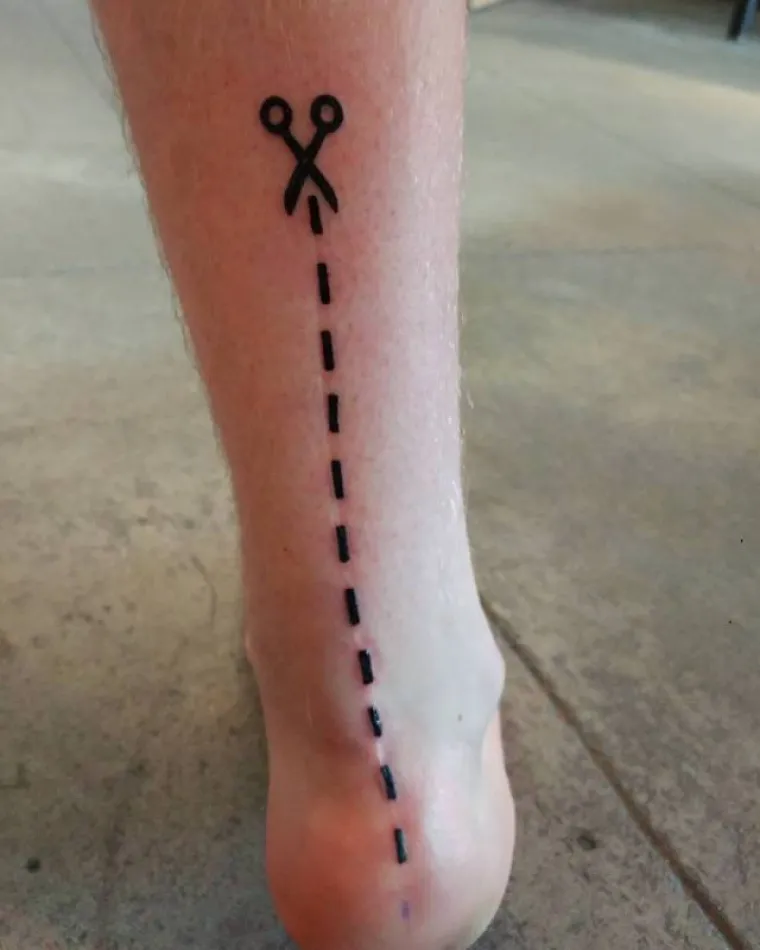 DUBOKE OŽILJKE PREKRILI TETOVAŽAMA: Od rana iz pro&scaron;losti uspjeli napraviti prava umjetnička djela