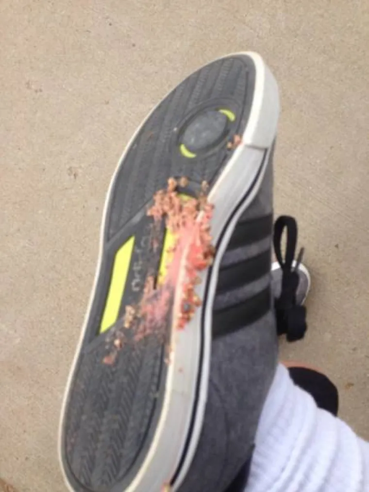 PODIJELILI STVARI KOJE IH UVIJEK NAŽIVCIRAJU: Male stvari koje mogu uzrokovati velike frustracije