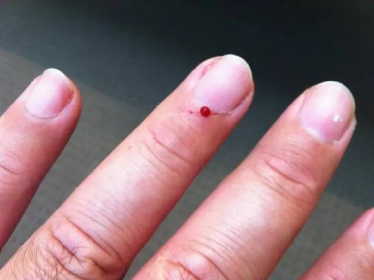 PODIJELILI STVARI KOJE IH UVIJEK NAŽIVCIRAJU: Male stvari koje mogu uzrokovati velike frustracije