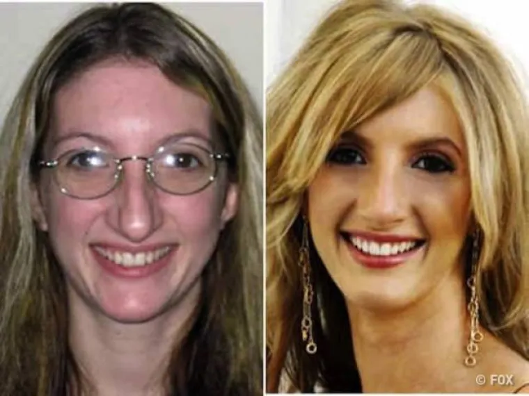 RUGALI SU IM SE ZBOG IZGLEDA, A ONDA SU SE POTPUNO PROMIJENILI: S godinama se pretvorili u prave labudove