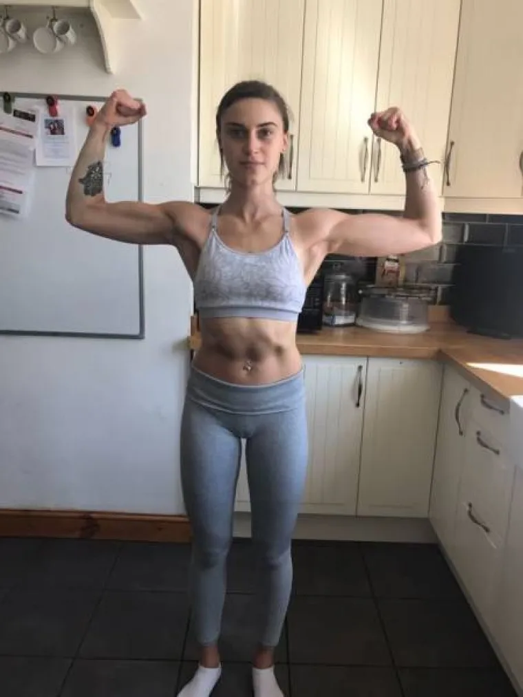 BILA JE NA RUBU SMRTI S 32 KILOGRAMA: Anoreksična djevojka objavila šokantne snimke svojeg oporavka