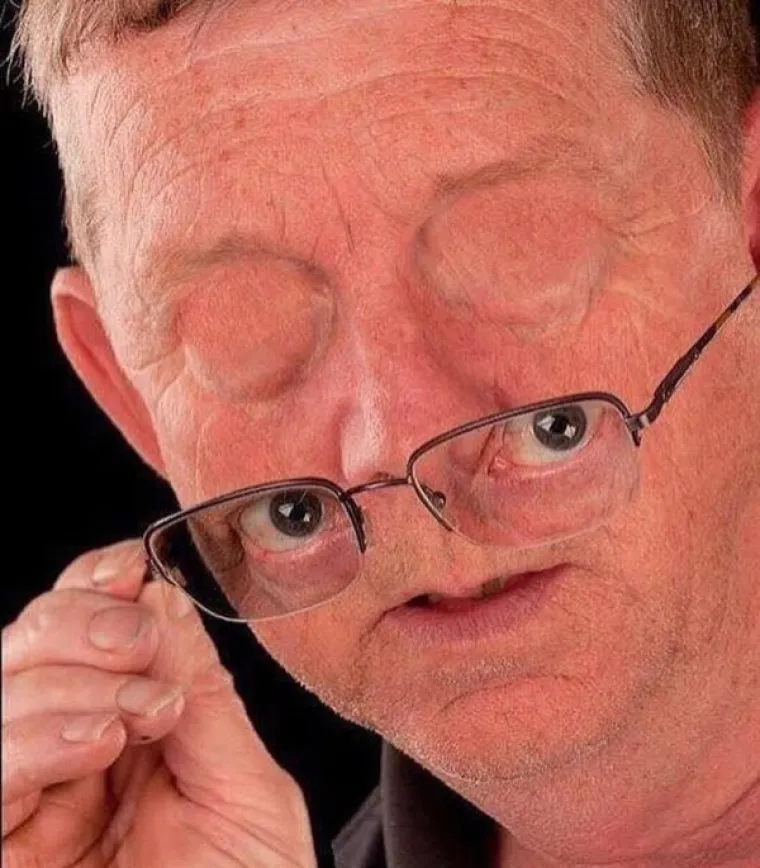 URNEBESNE PHOTOSHOP KATASTROFE: Bez obzira jesu li rezultati namjerni ili slučajni, rezultat je isti