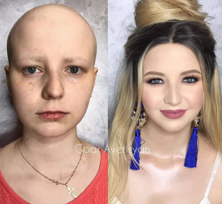 Goar Avetisyan je ruska vizažistica koja se na Instagramu voli pohvaliti nevjerojatnim rezultatima pa ima preko četiri milijuna fanova. Neke od preobrazbi koje je uspjela postići šminkom, a koje izgledaju bolje od plastičnih operacija pogledajte ovdje.