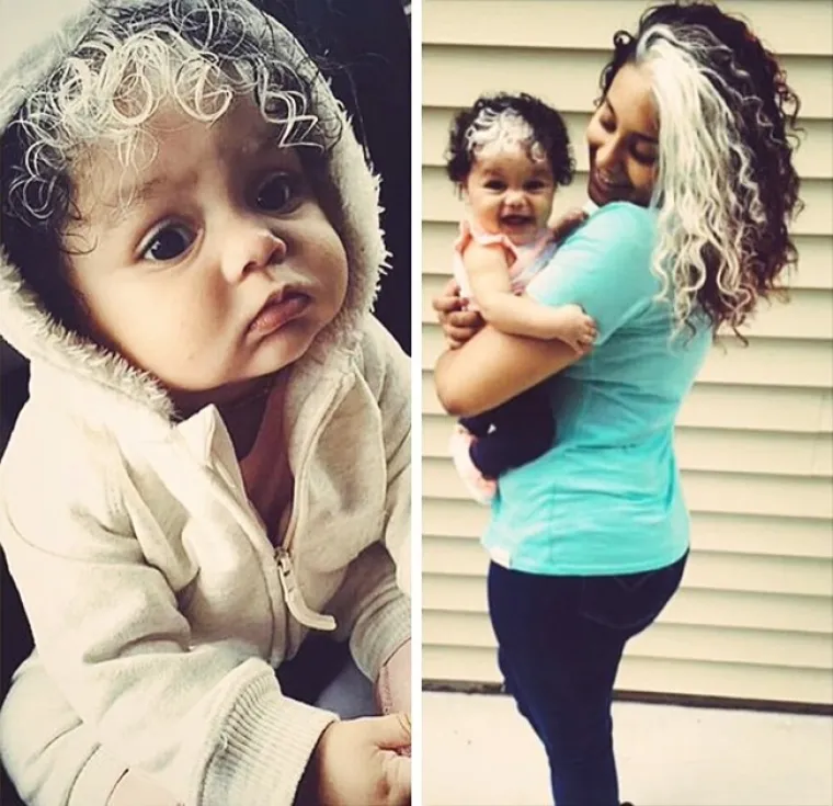 Obje imaju neobičan pigment kose.