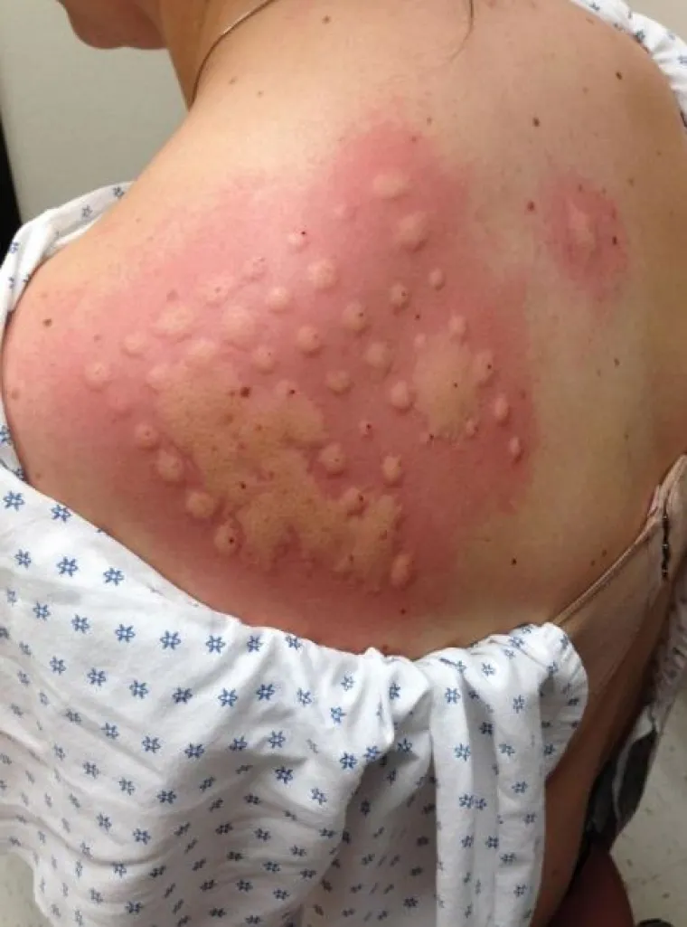 Ako mislite da vi imate lo&scaron; dan, pogledajte na&scaron;u fotogaleriju