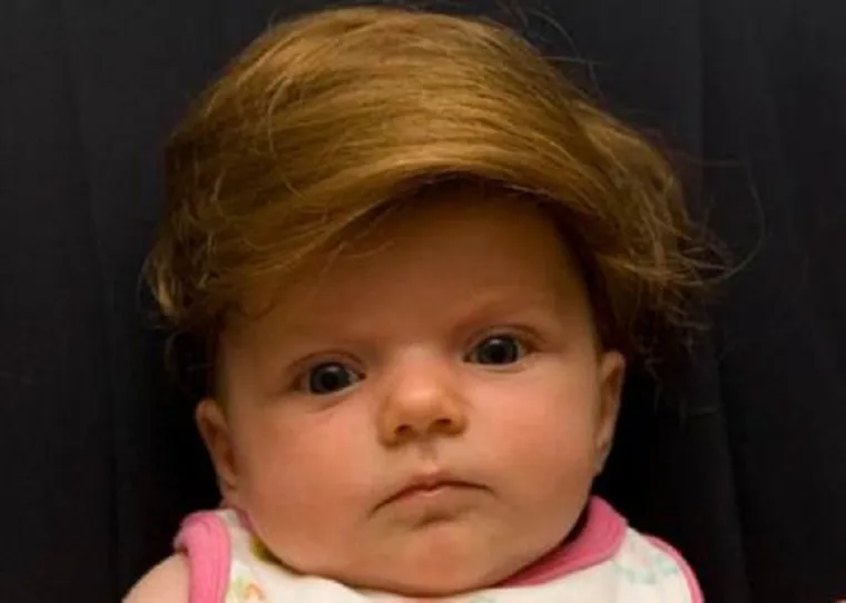 Za bebu koja ima sve, osim kose, tu je tupe