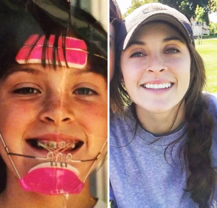 U &Scaron;KOLI SU IH ZVALI RUŽNIM PAČETOM, A POGLEDAJTE IH DANAS! Za Valentinovo odlučili pokazati koliko su se promijenili