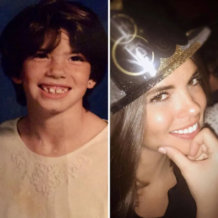 U &Scaron;KOLI SU IH ZVALI RUŽNIM PAČETOM, A POGLEDAJTE IH DANAS! Za Valentinovo odlučili pokazati koliko su se promijenili