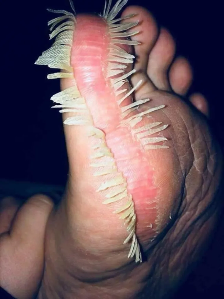 NAJBOLESNIJE FOTOGRAFIJE INTERNETA: Samo oni s najjačim želucem mogu doći do kraja