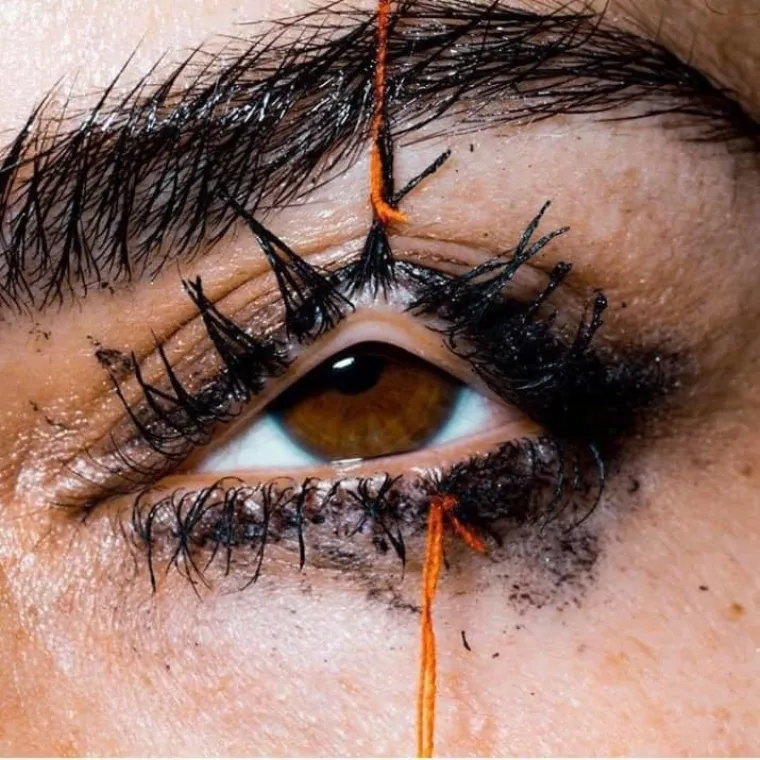 NAJBOLESNIJE FOTOGRAFIJE INTERNETA: Samo oni s najjačim želucem mogu doći do kraja