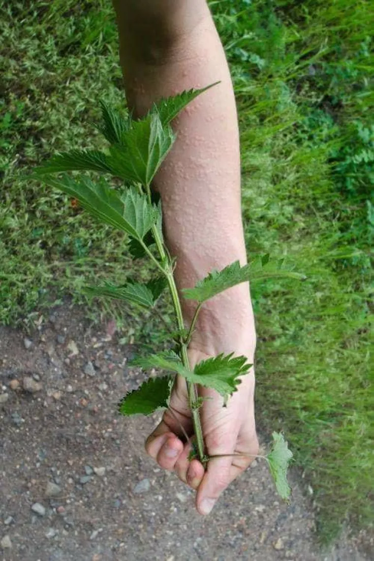 NAJBOLESNIJE FOTOGRAFIJE INTERNETA: Samo oni s najjačim želucem mogu doći do kraja