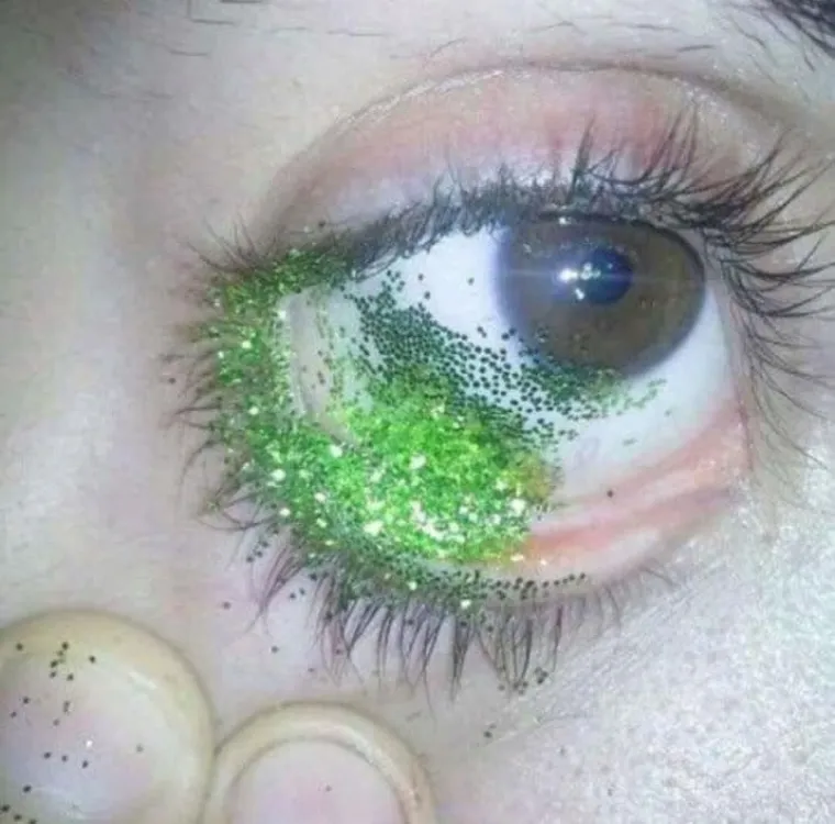 NAJBOLESNIJE FOTOGRAFIJE INTERNETA: Samo oni s najjačim želucem mogu doći do kraja