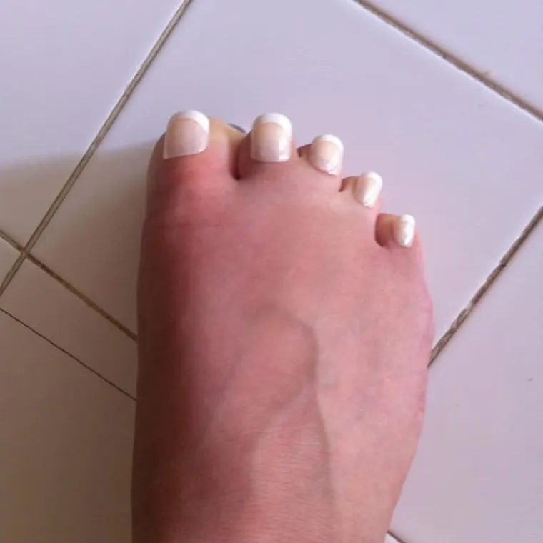 NAJBOLESNIJE FOTOGRAFIJE INTERNETA: Samo oni s najjačim želucem mogu doći do kraja