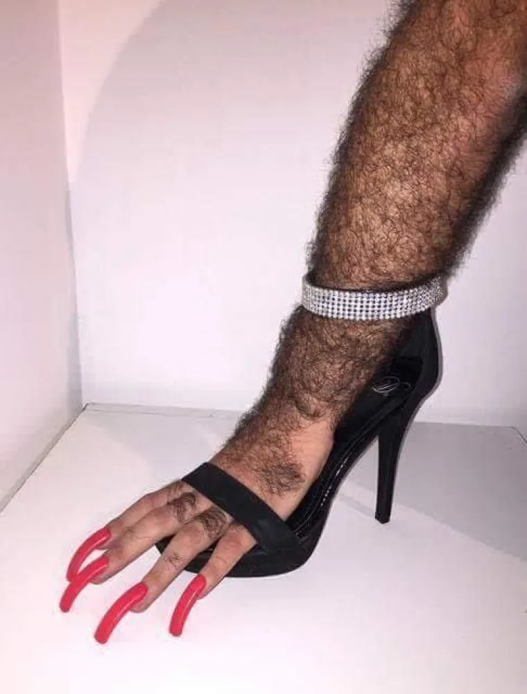 NAJBOLESNIJE FOTOGRAFIJE INTERNETA: Samo oni s najjačim želucem mogu doći do kraja