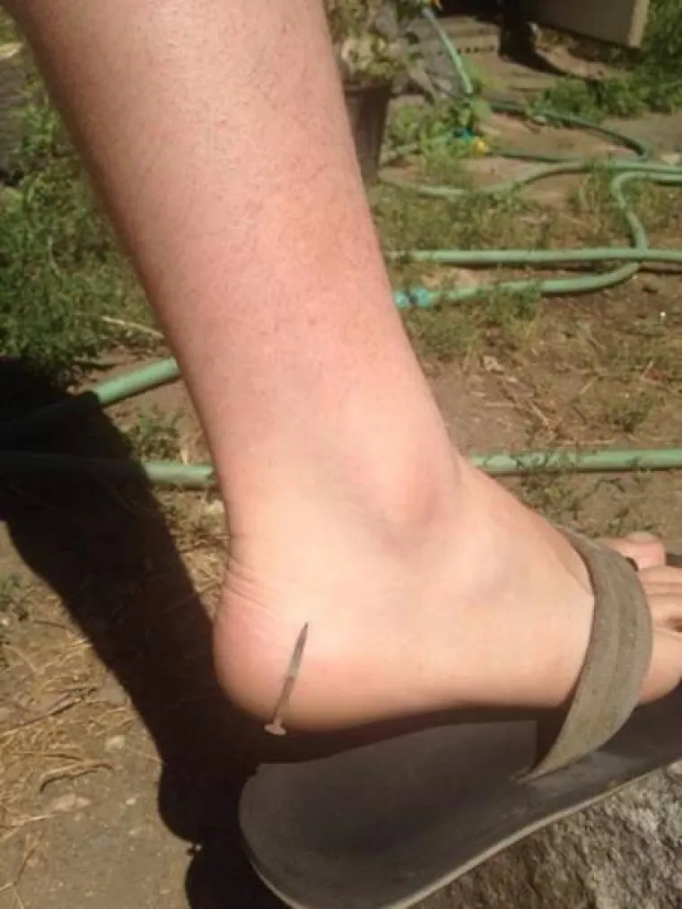 SVAKODNEVICA JE PUNA SITUACIJA OPASNIH PO ŽIVOT: Naučili na težak način da nezgoda čeka iza svakog ugla