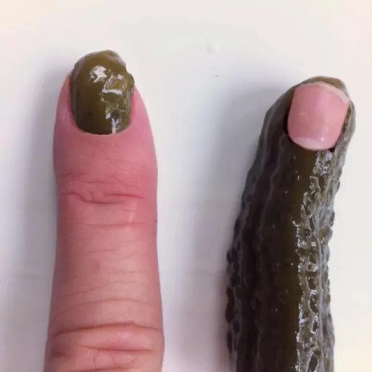 SAMO NAJHRABRIJI MOGU POGLEDATI OVU BOLESNU GALERIJU DO KRAJA: Uznemirujući prizori s 'one strane' interneta