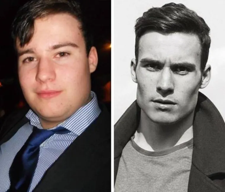 PODUZELI SVE MOGUĆE MJERE KAKO BI PROMIJENILI IZGLED: Sve se može uz malo &scaron;minke, tjelovježbe i operacija