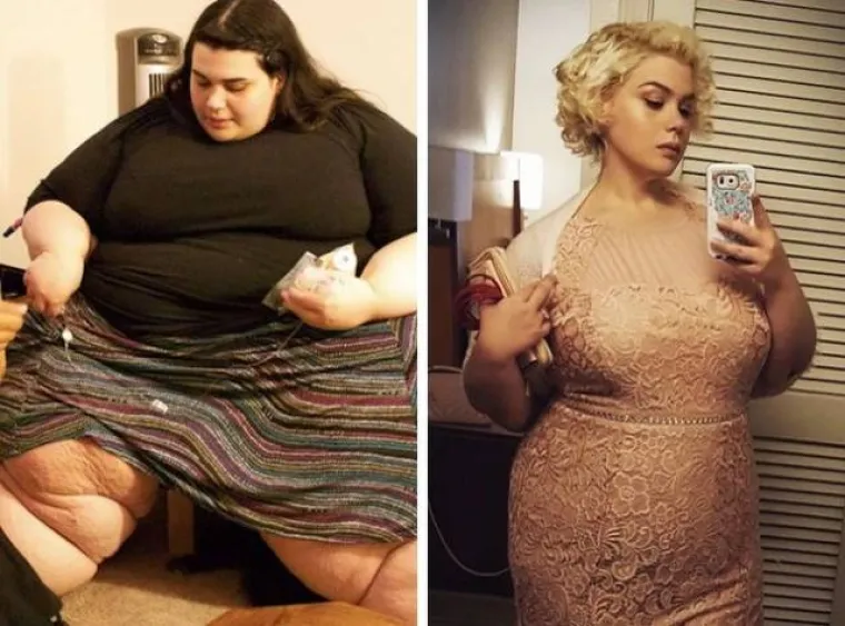 PODUZELI SVE MOGUĆE MJERE KAKO BI PROMIJENILI IZGLED: Sve se može uz malo &scaron;minke, tjelovježbe i operacija