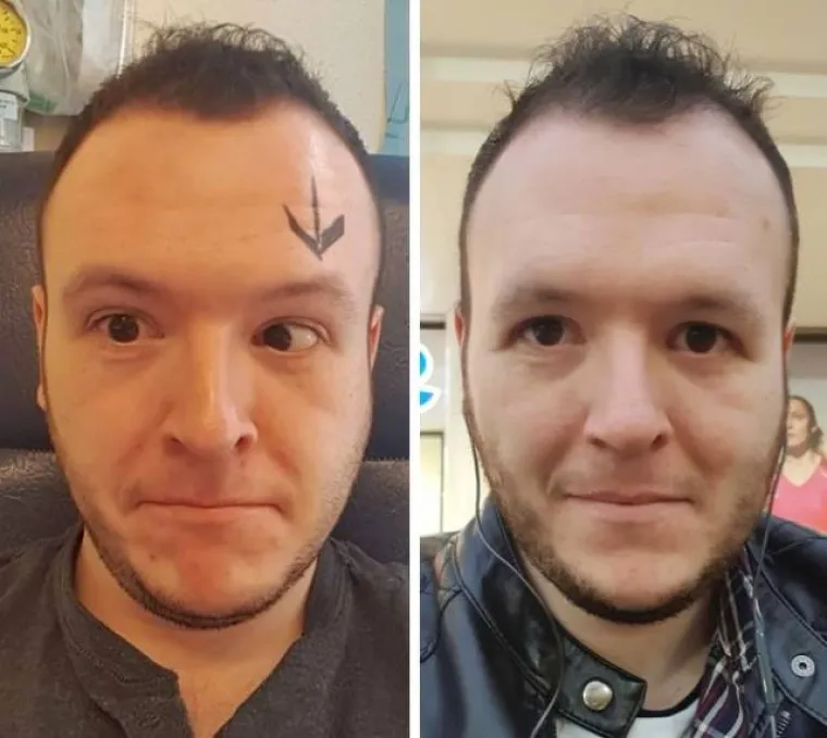 PODUZELI SVE MOGUĆE MJERE KAKO BI PROMIJENILI IZGLED: Sve se može uz malo &scaron;minke, tjelovježbe i operacija