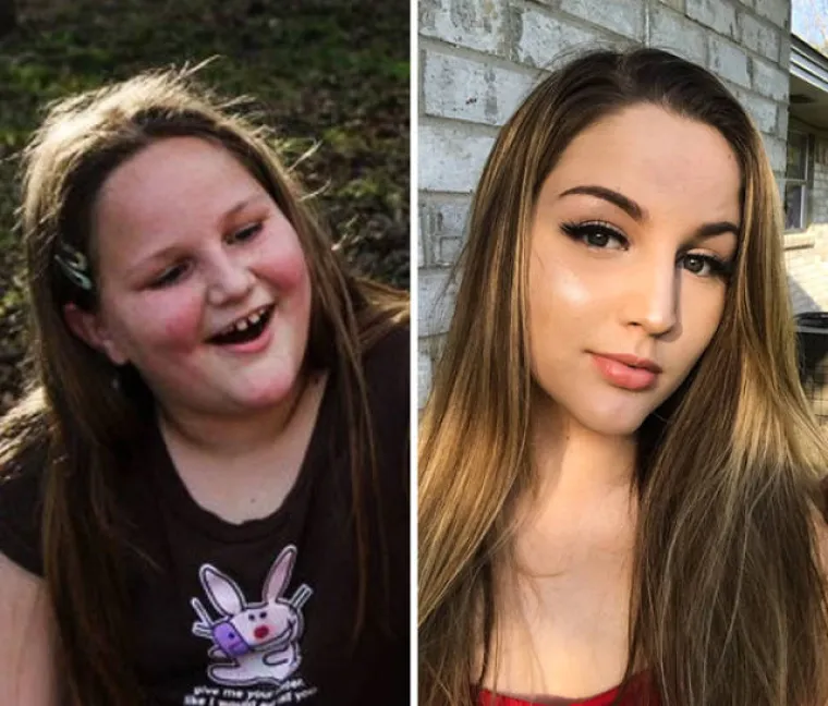 ŠEST GODINA MOŽE POTPUNO PROMIJENITI LJUDE: Podijelili nevjerojatne fotografije svoje transformacije