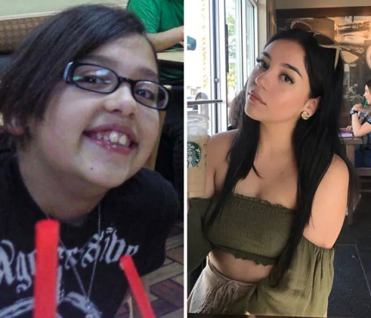 &Scaron;EST GODINA MOŽE POTPUNO PROMIJENITI LJUDE: Podijelili nevjerojatne fotografije svoje transformacije