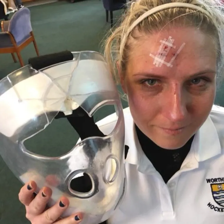 SREĆA JE NA NJIHOVOJ STRANI, POGLEDAJTE ŠTO SU SVE PREŽIVJELI: Ako imate sreće, ne treba vam baš puno pameti