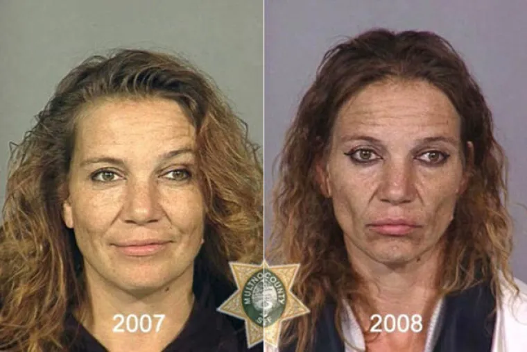 DROGA MOŽE POTPUNO IZOBLIČITI LJUDE U SAMO PAR MJESECI: Policija objavila fotografije kako bi upozorila ljude na opasnu drogu