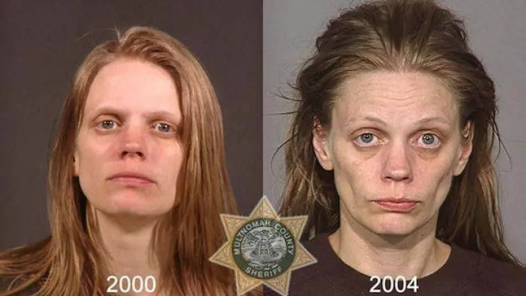 DROGA MOŽE POTPUNO IZOBLIČITI LJUDE U SAMO PAR MJESECI: Policija objavila fotografije kako bi upozorila ljude na opasnu drogu