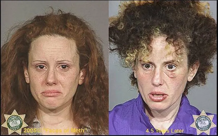 DROGA MOŽE POTPUNO IZOBLIČITI LJUDE U SAMO PAR MJESECI: Policija objavila fotografije kako bi upozorila ljude na opasnu drogu