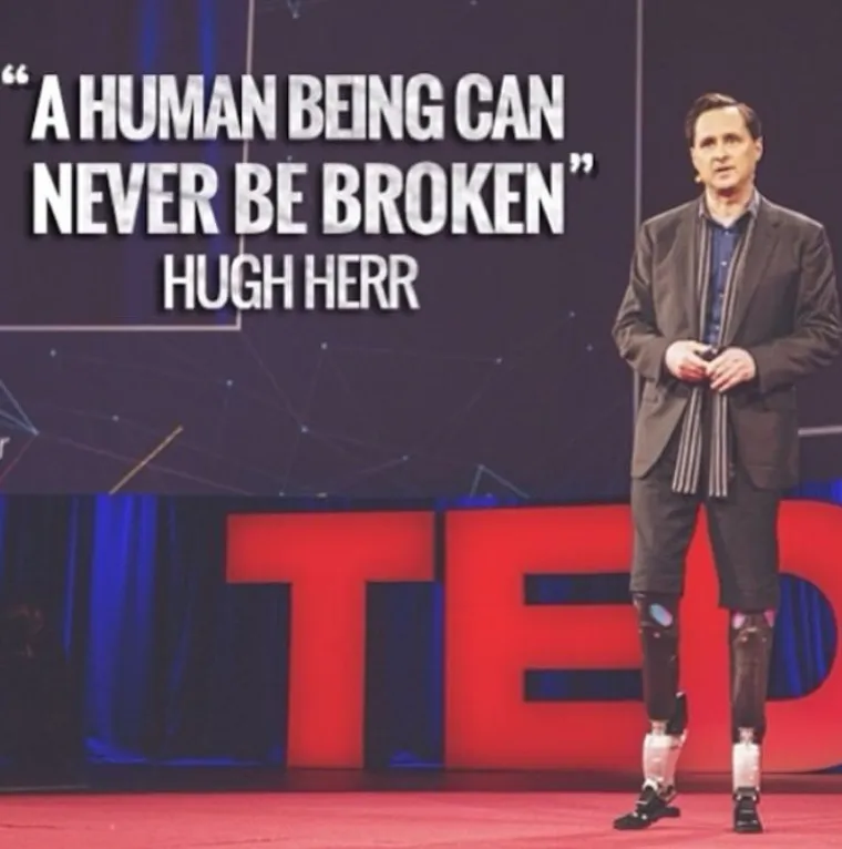 Ovih četvero talentiranih ljudi posramit će svakoga tko kaže: 'Ja to ne mogu'