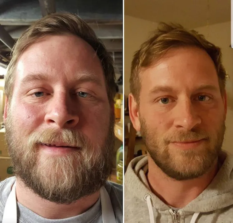 U galeriji smo okupili ljude koji su na društvenim mrežama koji su se odrekli alkohola. Oni su podijelili fotografije svoje transformacije, a kakve sve pozitivne posljedice može imati odricanje od alkohola, provjerite u nastavku.