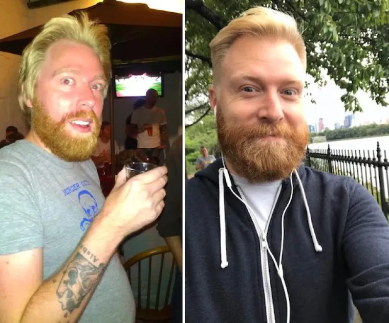 NEVJEROJATNO &Scaron;TO SE TIJELU DOGODI KADA PRESTANETE PITI ALKOHOL: Podijelili svoje preobrazbe na dru&scaron;tvenim mrežama