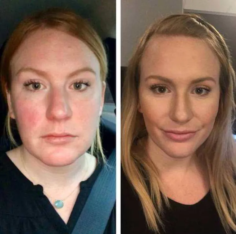 NEVJEROJATNO &Scaron;TO SE TIJELU DOGODI KADA PRESTANETE PITI ALKOHOL: Podijelili svoje preobrazbe na dru&scaron;tvenim mrežama