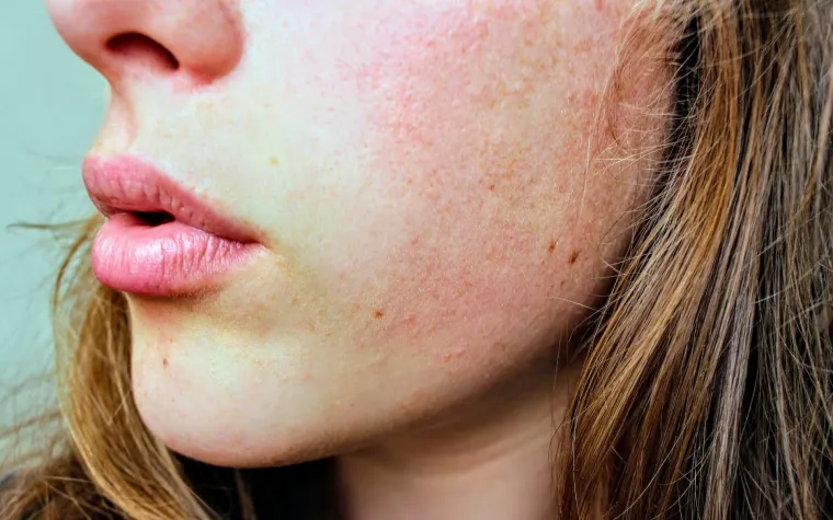 Pronašli smo najbolja rješenja za ljetne 'beauty' probleme